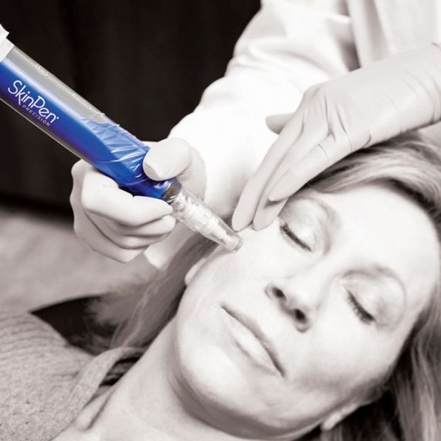 Platelet Rich Plasma (PRP) & SkinPen Facial 